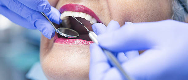 Best Emergency Denture Repair in Sun Village, CA